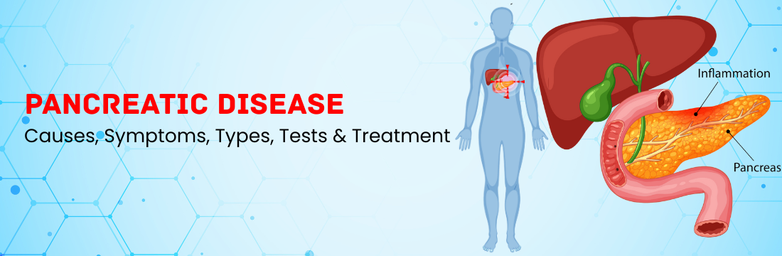 Pancreatic Disease: Causes, Symptoms, Types, Tests & Treatment